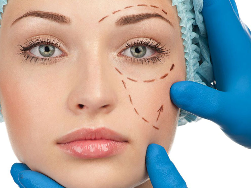 Chirurgie esthétique du visage