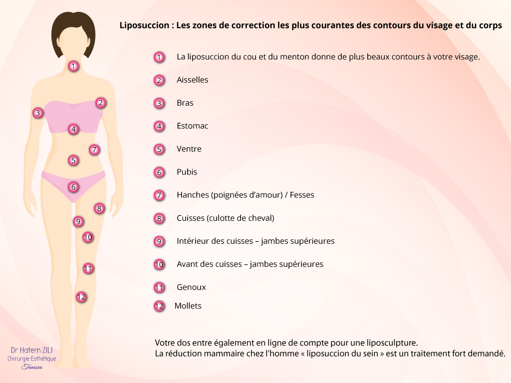 Liposuccion les plus courantes des contours du visage et du corps Liposuccion Les zones de correction