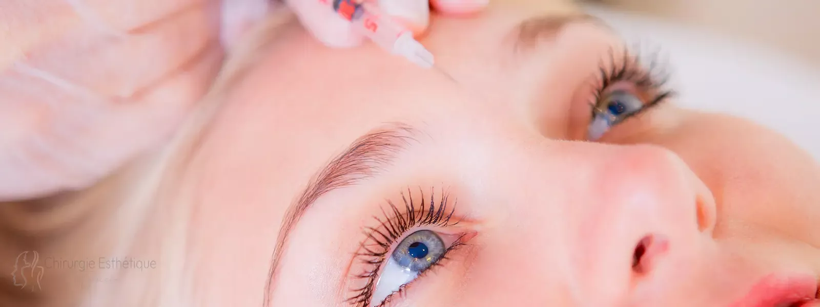 Injection du botox à la ride du lion