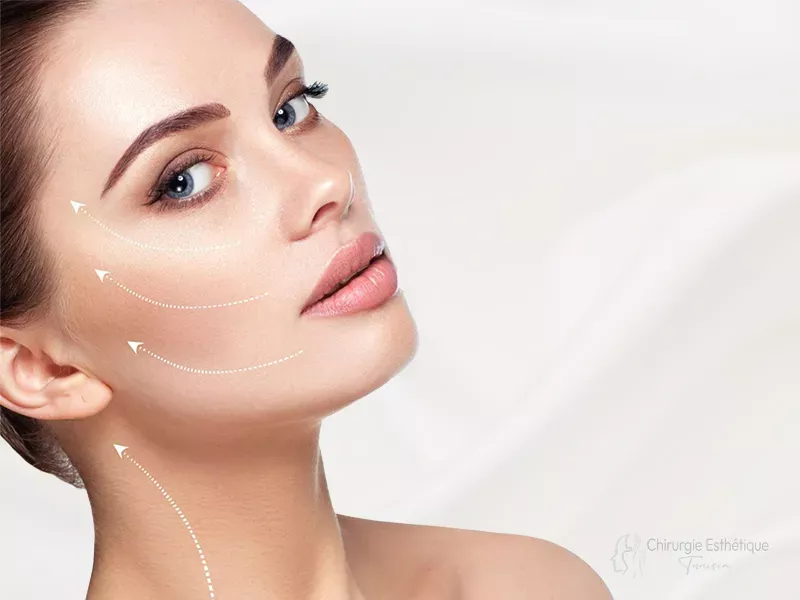 Lifting cervico-facial