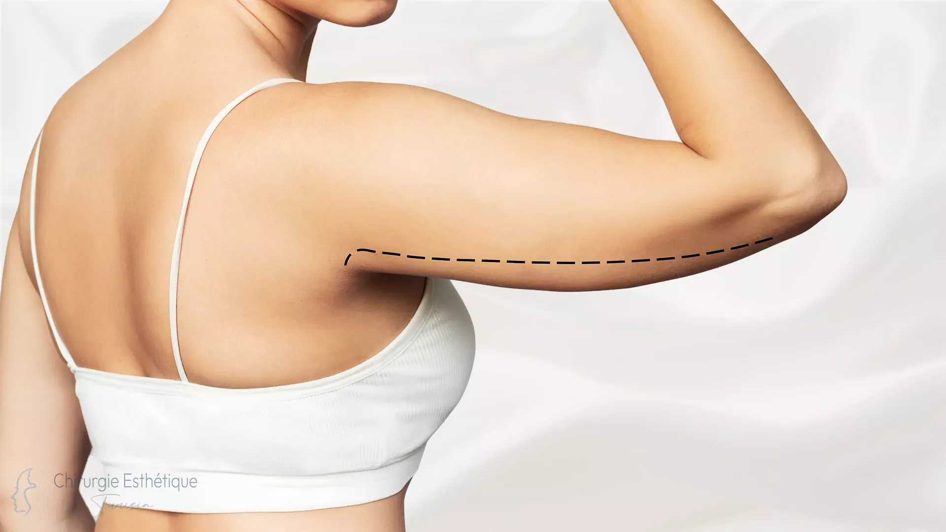 Lifting des bras