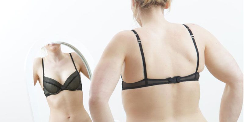les effets positifs de la chirurgie esthétique