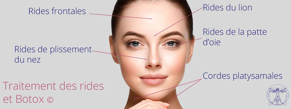 injection de Botox