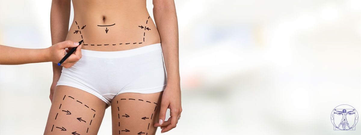 Bodylift