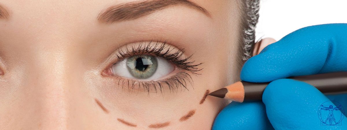 Blépharoplastie