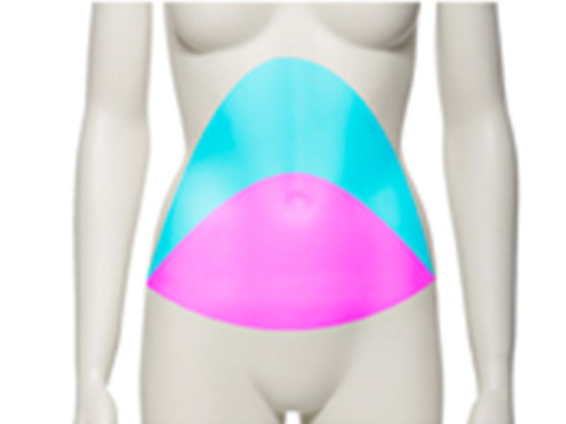 Abdominoplastie décollement