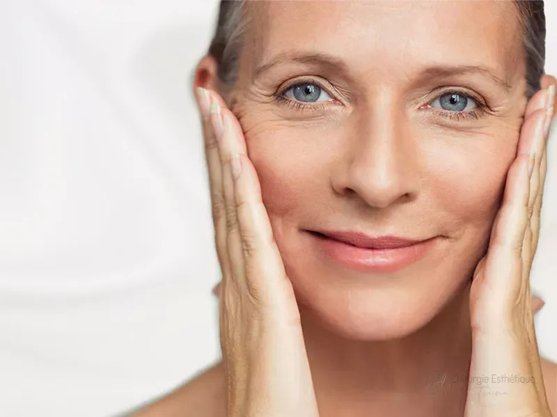 Lifting Cervico-Facial pour une femme de plus de 50 ans